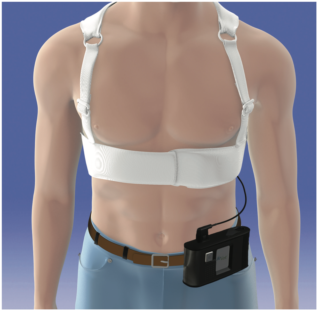 Wearable Cardioverter Defibrillators (WCDs) for Protection From Sudden
